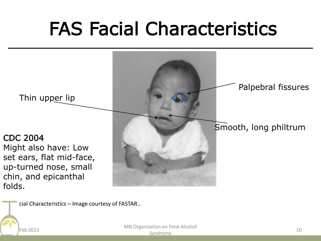 PPT - Working with kids with Fetal Alcohol Spectrum Disorders (FASD ...