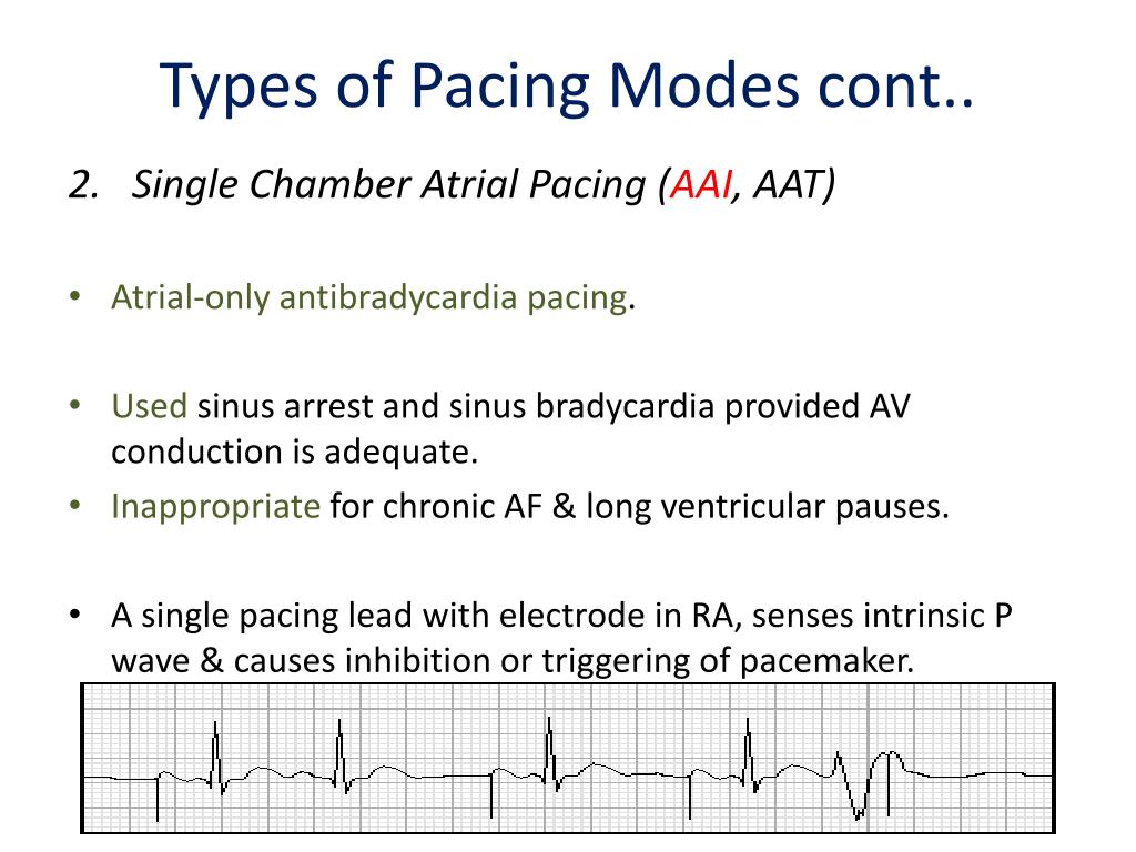 PPT - Anesthetic Considerations In Patients with Cardiac Pacemaker ...