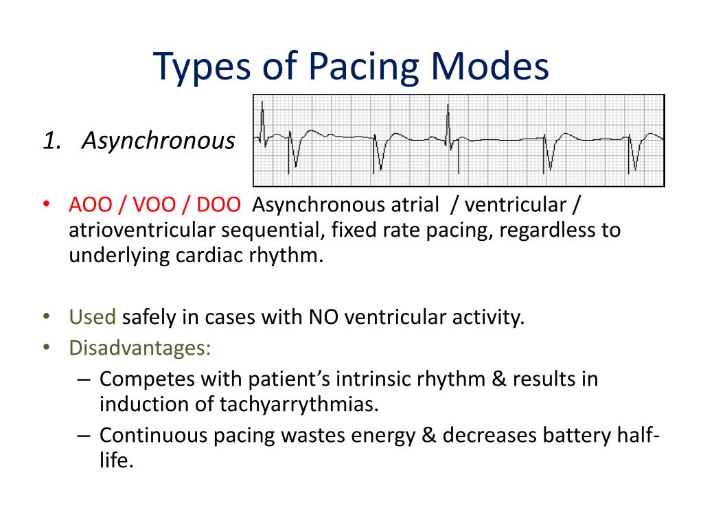 PPT - Anesthetic Considerations In Patients with Cardiac Pacemaker ...