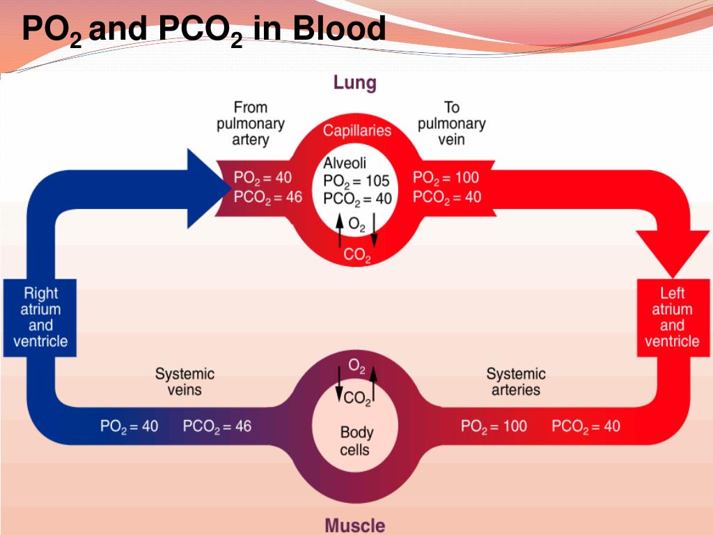 Arterial Blood Gas Sampling