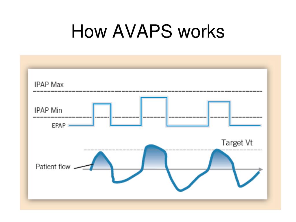 PPT Beyond Traditional PAP therapy PowerPoint Presentation, free