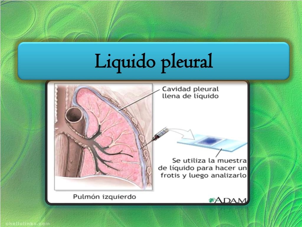 Ppt Liquido Pleural Y Liquido Pericardico Powerpoint Presentation Free Download Id2362265 7167