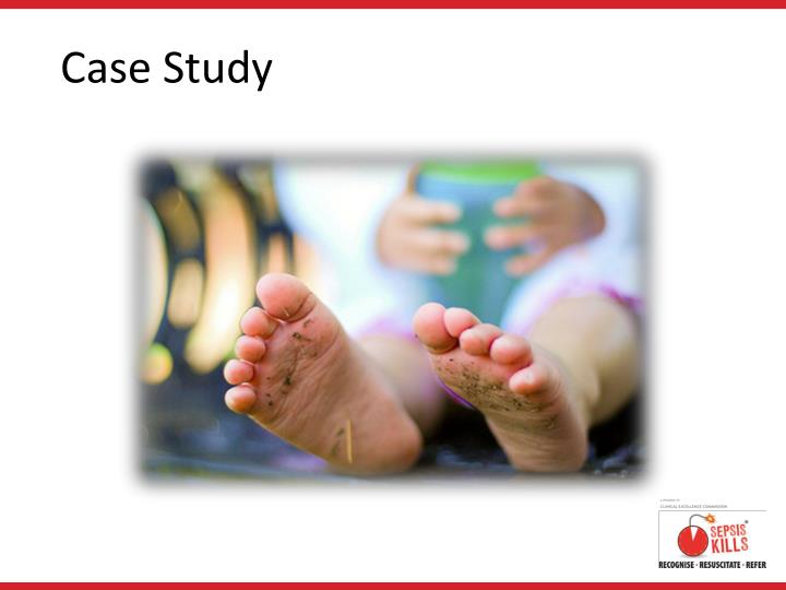 Case study sepsis nursing