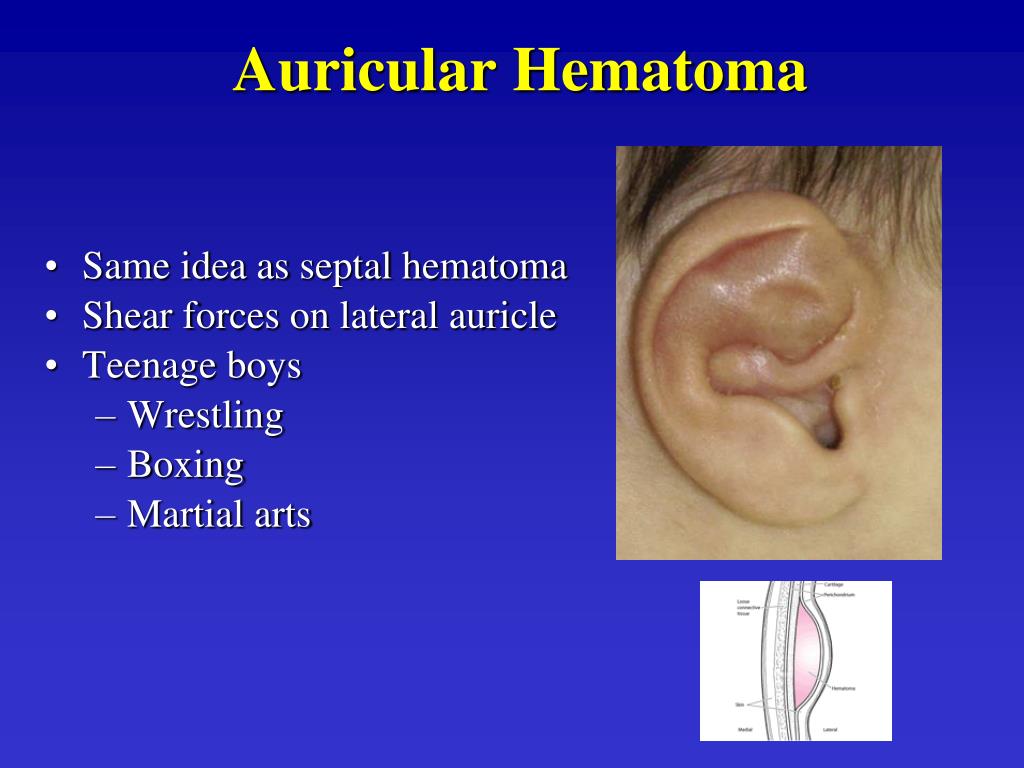 aural hematomas aural hematomas