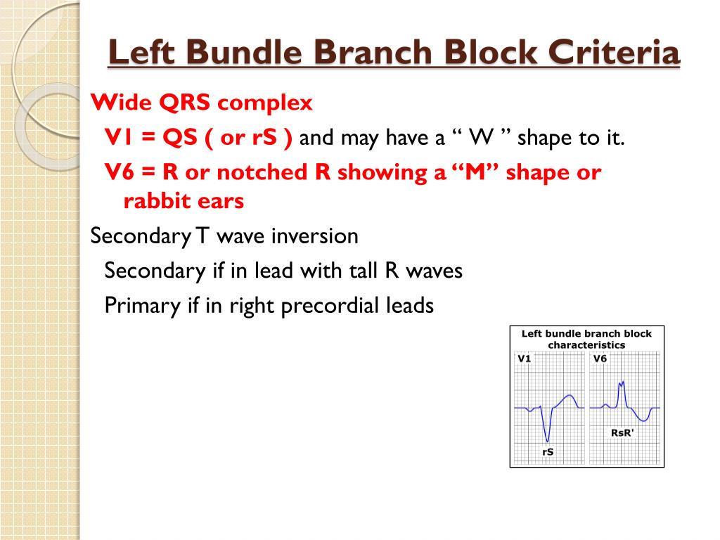 PPT BUNDLE BRANCH BLOCK PowerPoint Presentation, free download ID