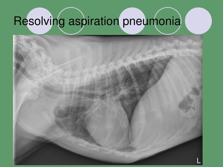 PPT Bronchial Atresia PowerPoint Presentation ID2363520