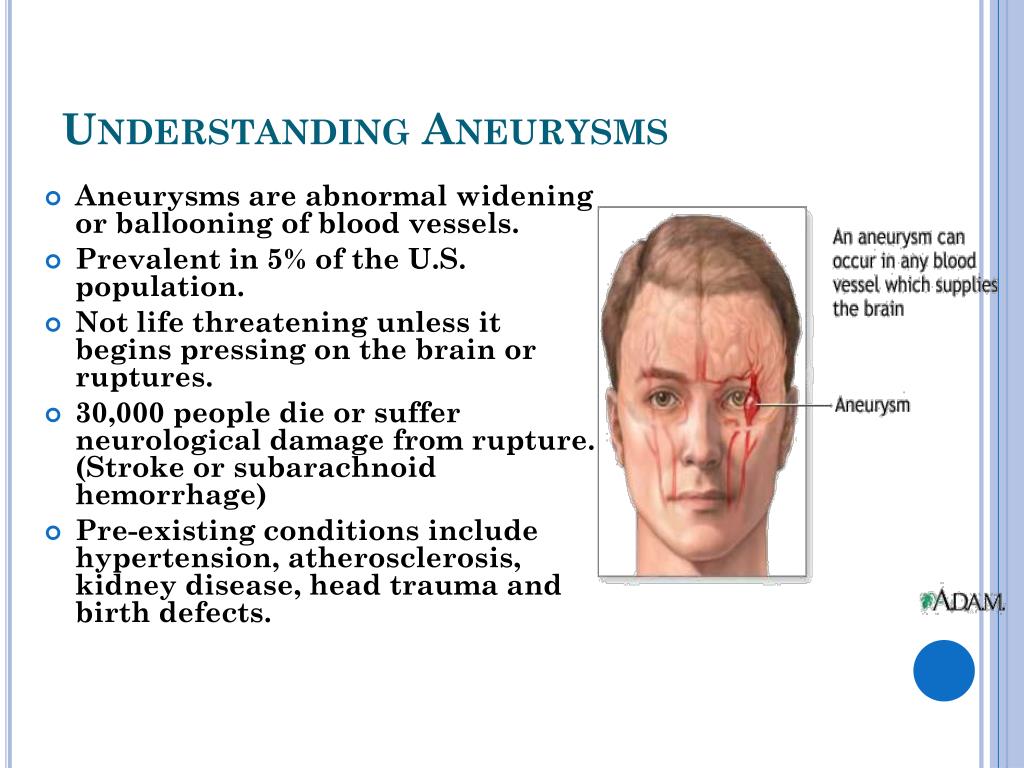 PPT - Innovative Solutions for Treating Cerebral Aneurysms with Shape ...