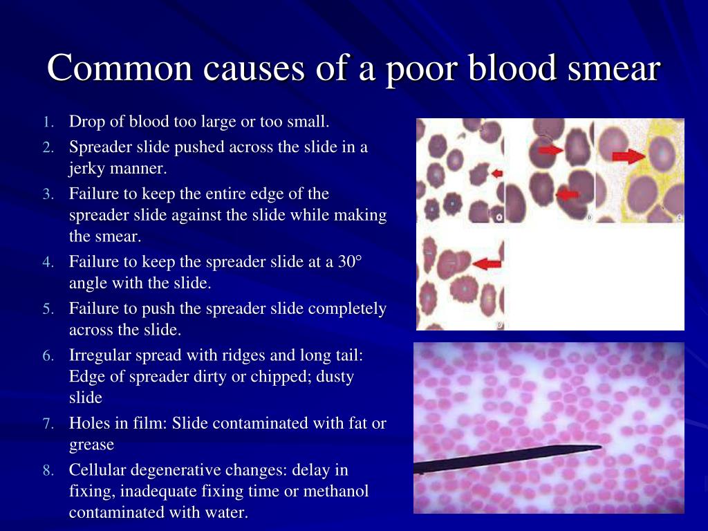 PPT - MORPHOLOGIC CHANGES DUE TO AREA OF SMEAR PowerPoint ...