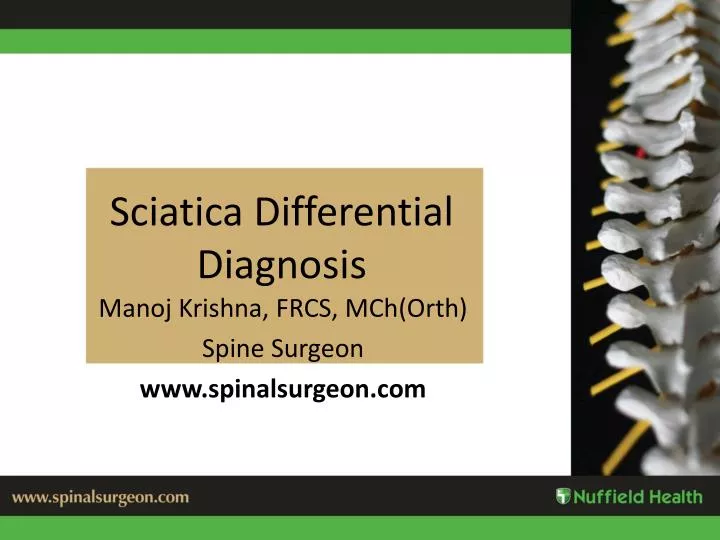 PPT Sciatica Differential Diagnosis PowerPoint
