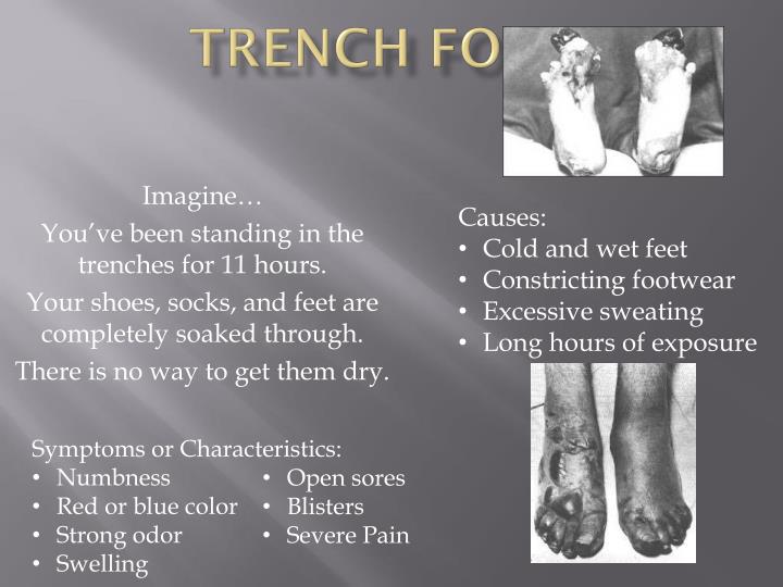 Ppt Trench Foot Powerpoint Presentation Id2376878