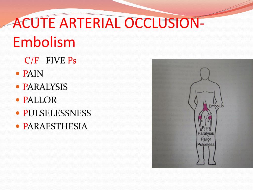 PPT - ARTERIAL DISEASES PowerPoint Presentation, free..