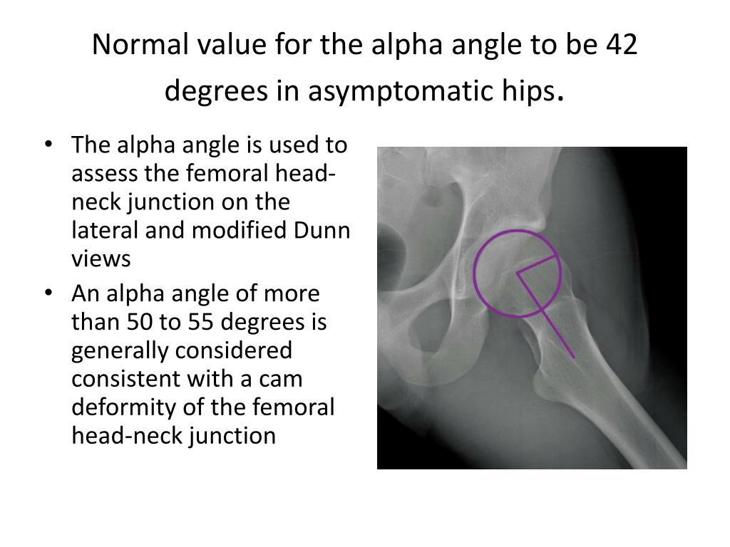 Normal Alpha Angle Hip Xray Engineeringbillo normal-alpha-angle-hip-xray-engineeringbillo