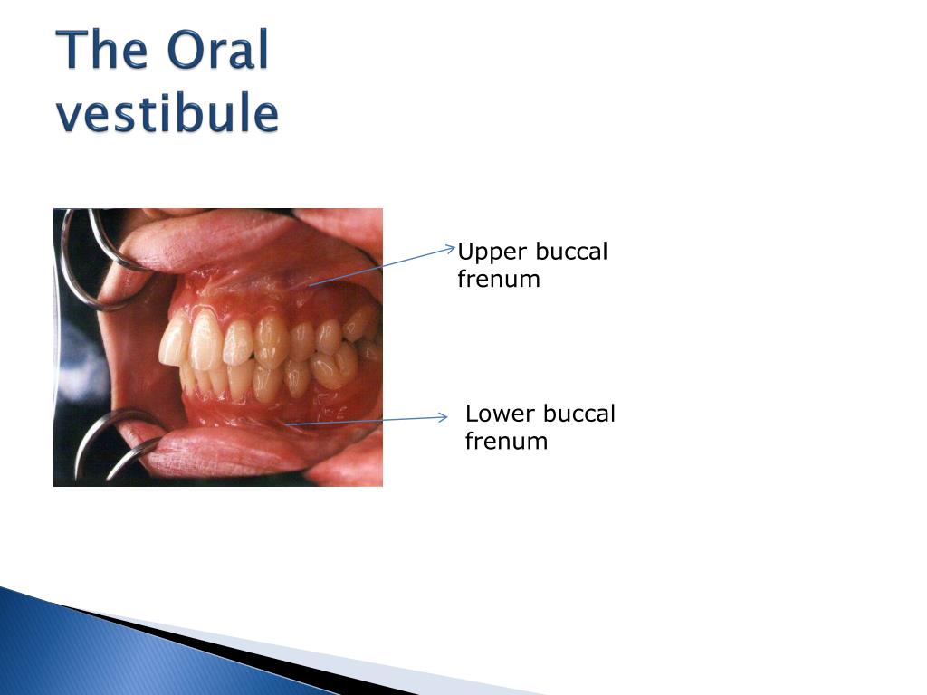 PPT - ORAL ANATOMY PowerPoint Presentation, free download - ID:2381675