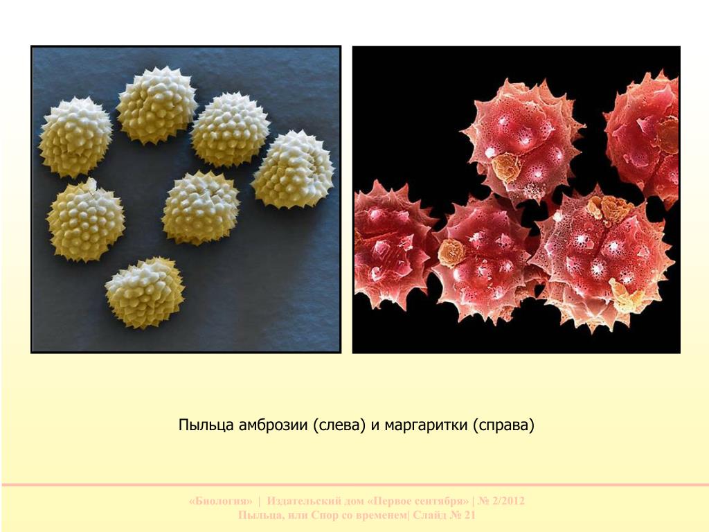 Появление пыльцы. Пыльца амброзии. Пыльца амброзии под микроскопом. Пыльца растений под микроскопом. Пыльцевые зерна под микроскопом.