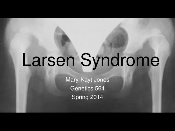 larsen syndrome n.