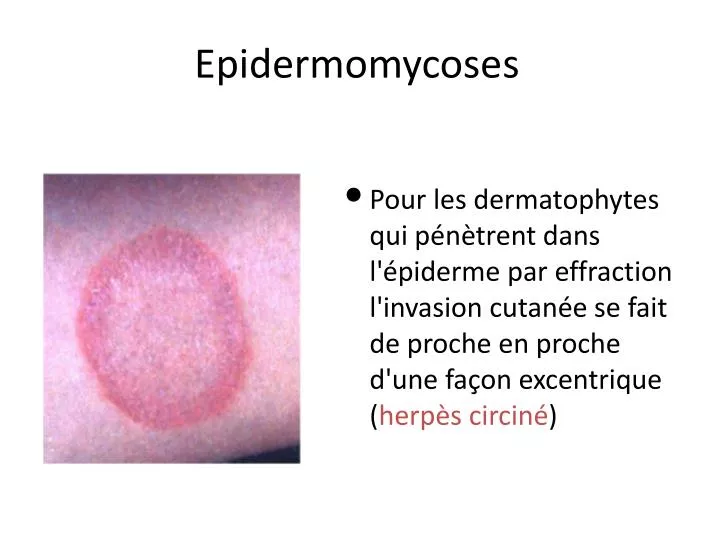 Herp s Circin Herp s Comment Le Reconna tre Et Le Soigner AQAN herp-s-circin-herp-s-comment-le-reconna-tre-et-le-soigner-aqan