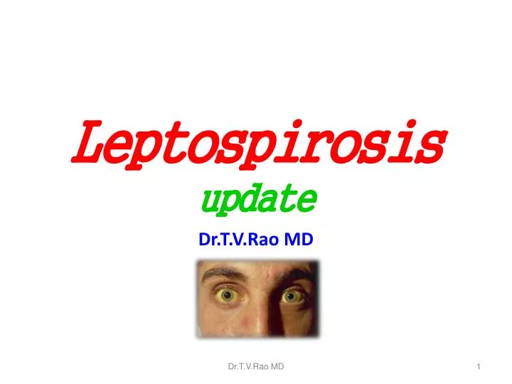 PPT Leptospirosis Update PowerPoint Presentation Free Download ID 