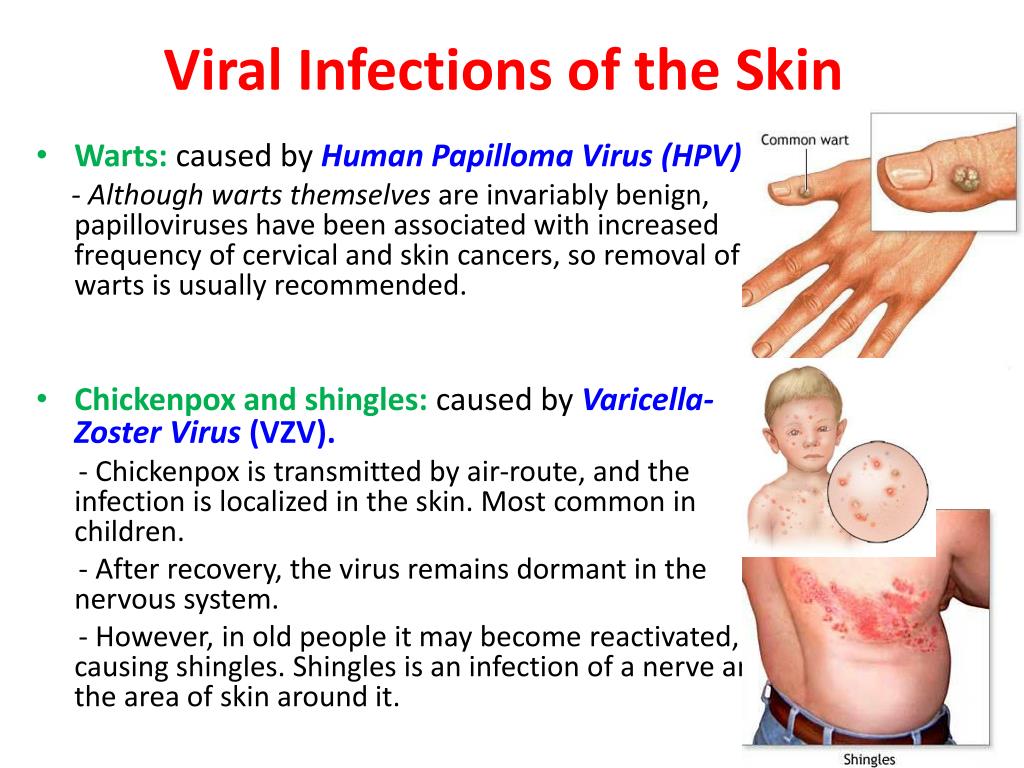 thesis on skin infections