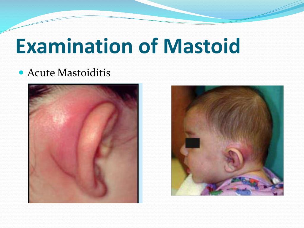 PPT introduction to ENT History and Clinical Examination PowerPoint