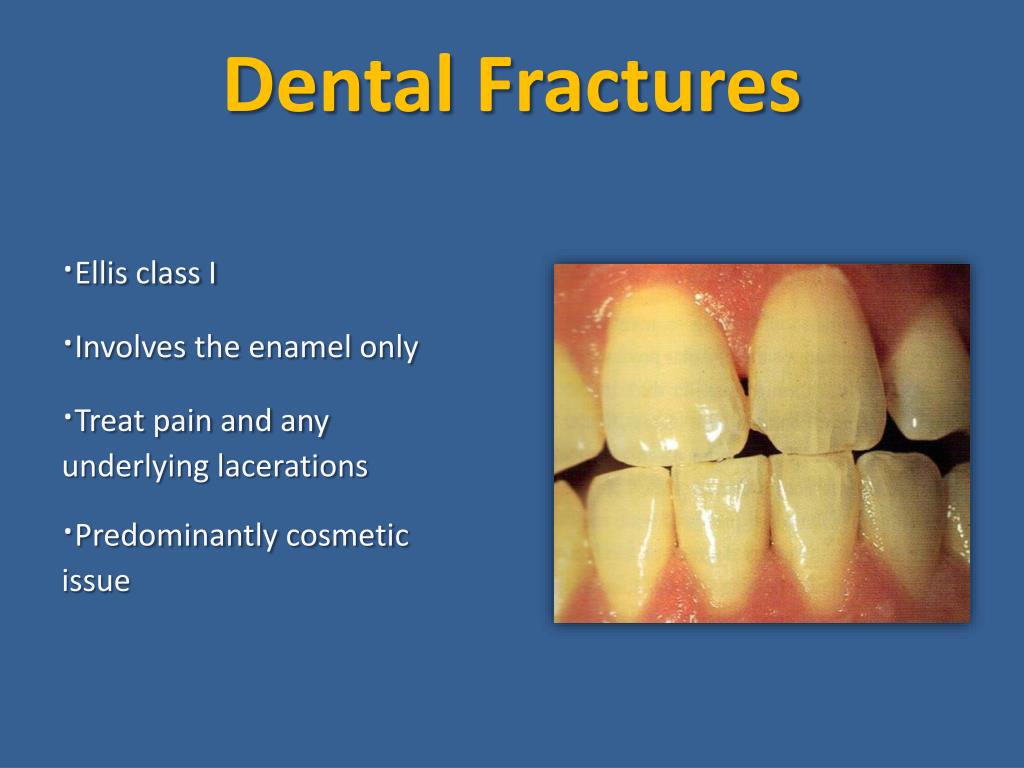 PPT - Facial Trauma PowerPoint Presentation, free download - ID:2392727