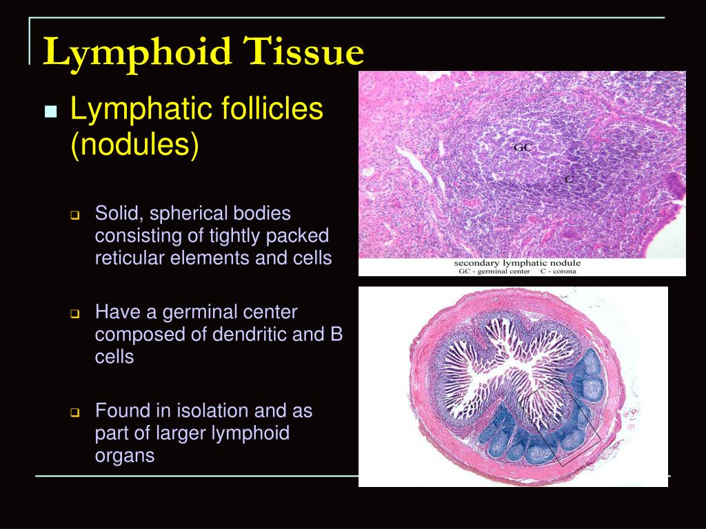 PPT - Lymphatic tissue PowerPoint Presentation, free download - ID:2393505
