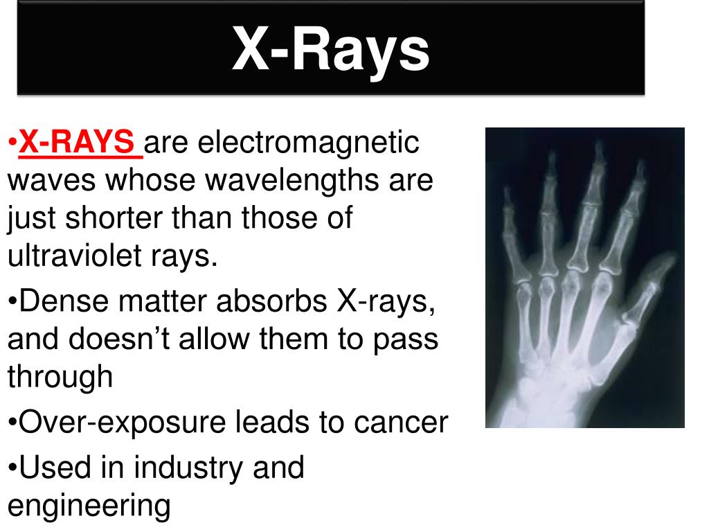 do x rays travel at the speed of light