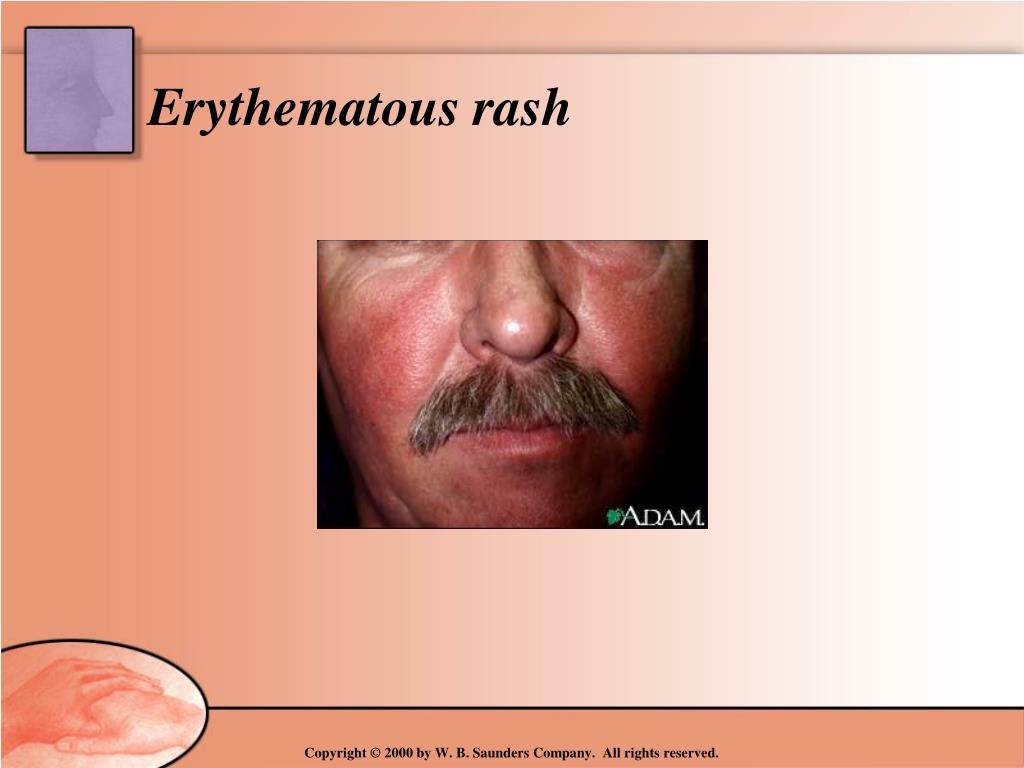 PPT - Assessment Physical Examination of the Skin By Sharon Kerr MSN ...