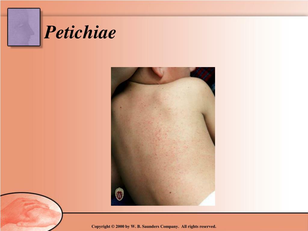 PPT - Assessment Physical Examination of the Skin By Sharon Kerr MSN ...