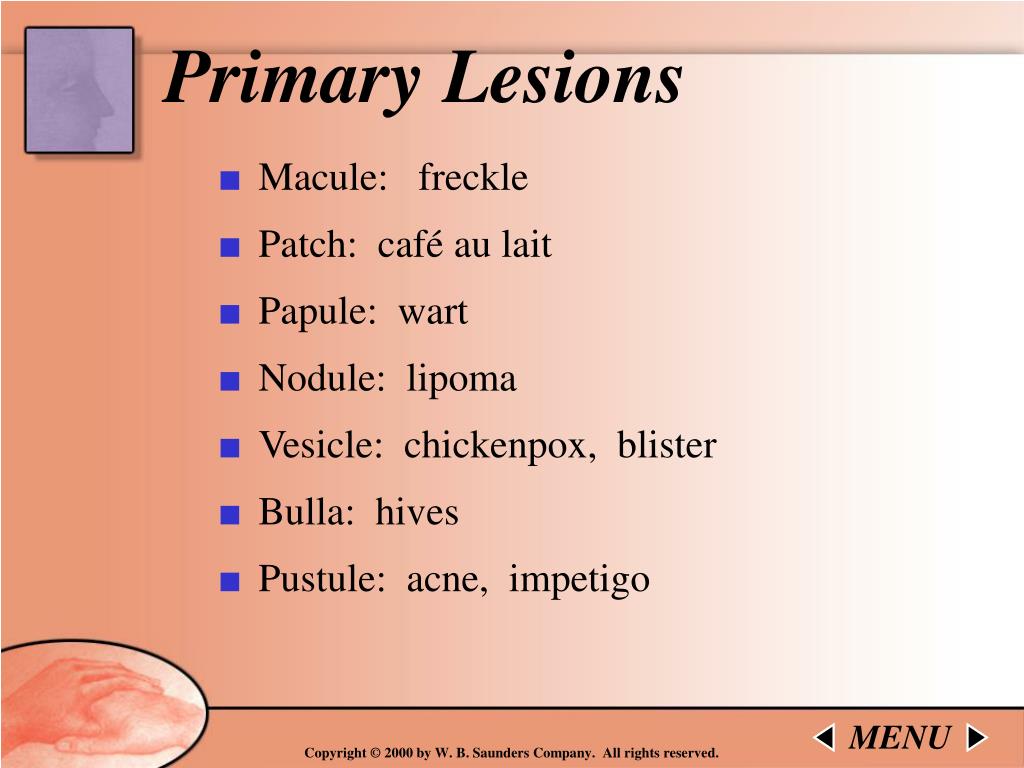 PPT - Assessment Physical Examination of the Skin By Sharon Kerr MSN ...
