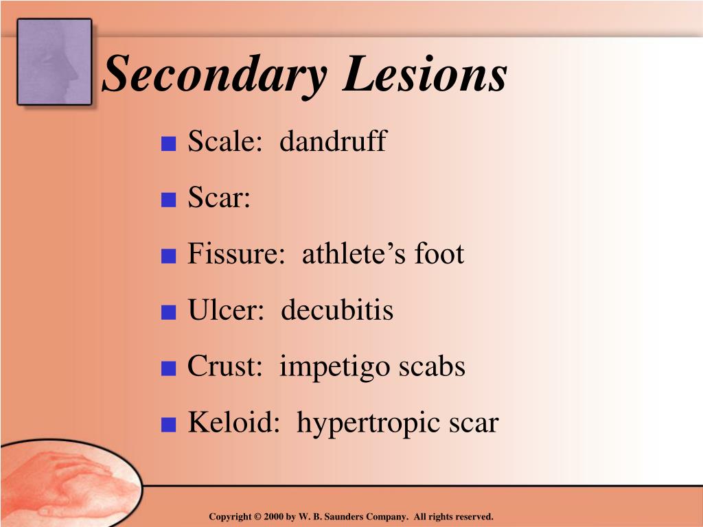 PPT - Assessment Physical Examination of the Skin By Sharon Kerr MSN ...