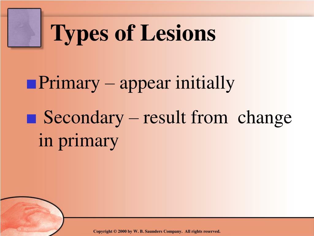 PPT - Assessment Physical Examination of the Skin By Sharon Kerr MSN ...