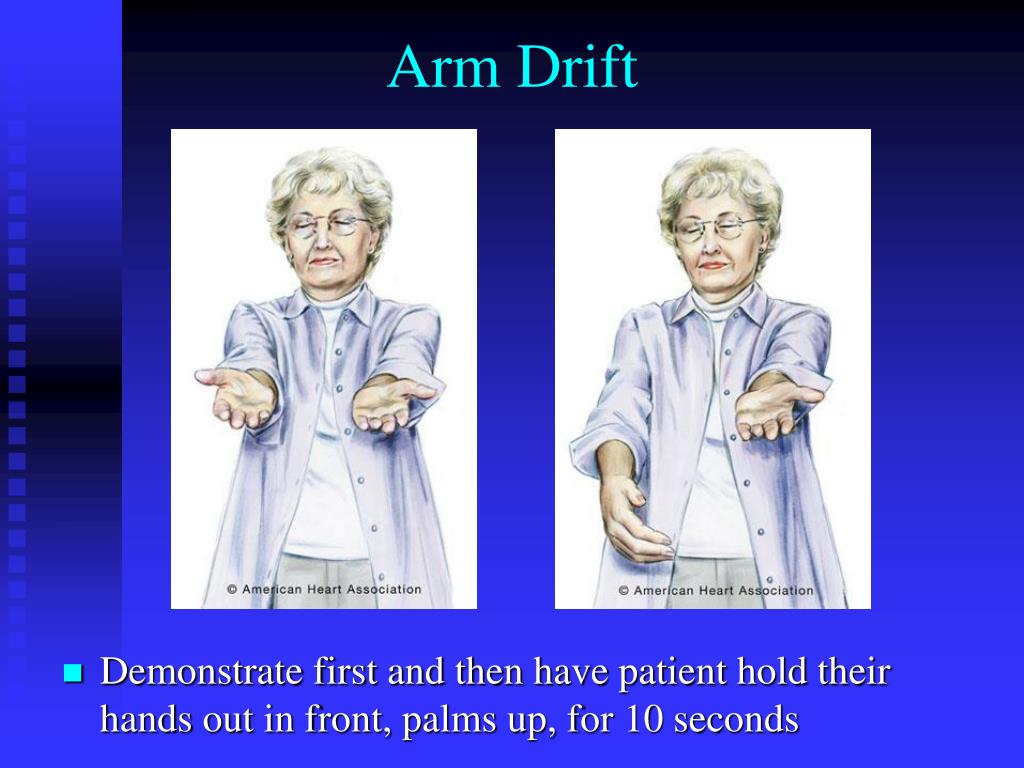 PPT Cardiac Nervous System Review of Emergencies 