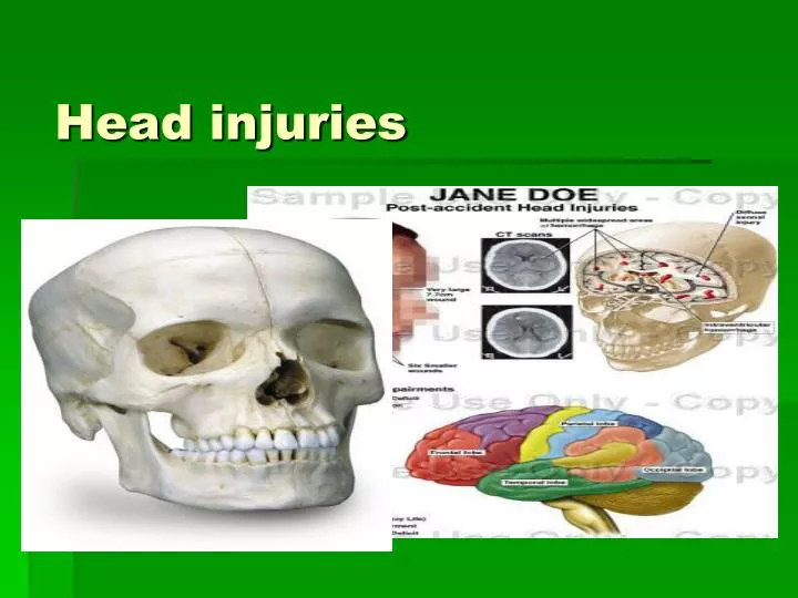 PPT Head Injuries PowerPoint Presentation Free Download ID 2409979 PPT Head Injuries PowerPoint Presentation Free Download ID 2409979
