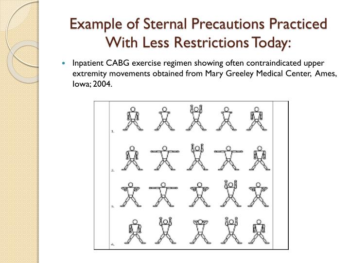PPT Sternal Precautions vs. Restrictions Is It Time For A Change