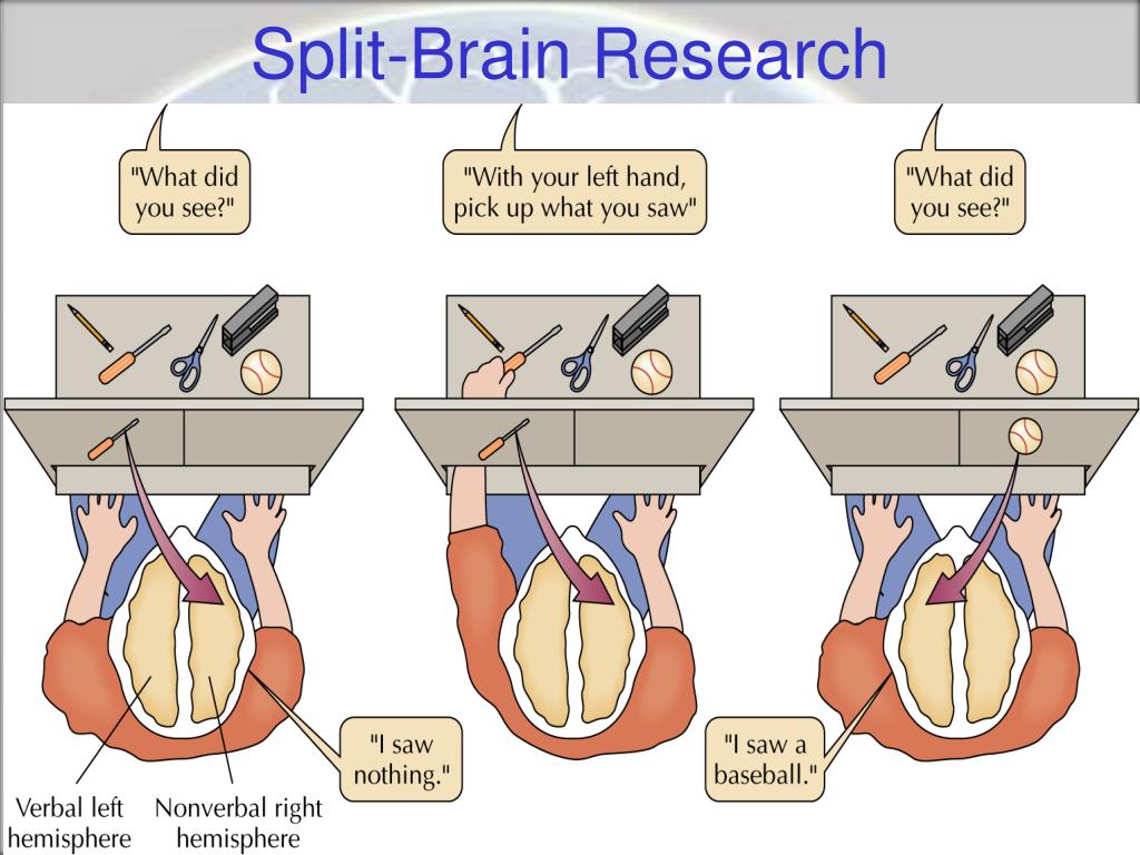 Split brain. Исследования расщепленного мозга. Сперри расщепленный мозг. Газзанига расщепленный мозг.
