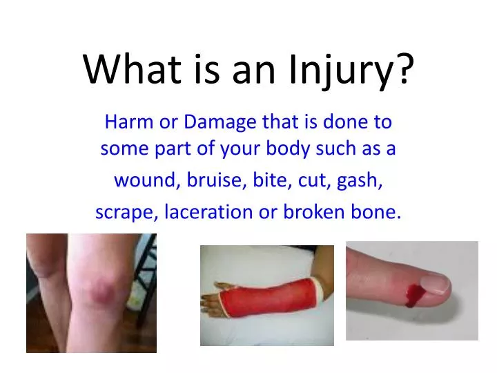 PPT - What is an Injury? PowerPoint Presentation, free download - ID ...