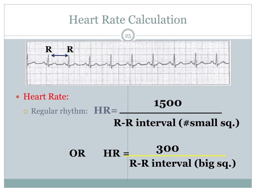 PPT The Elecrocardiogram ECG PowerPoint Presentation Free Download PPT The Elecrocardiogram ECG PowerPoint Presentation Free Download