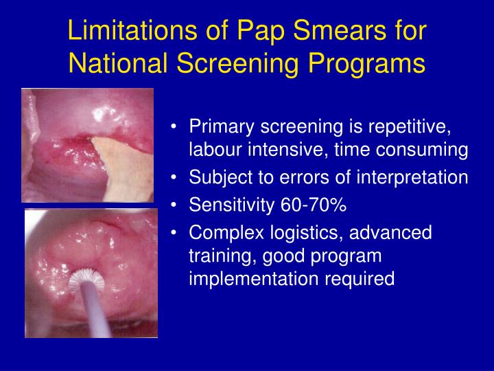Natural History Of Cervical Cancer Ppt Natural History Of Cervical Cancer Ppt