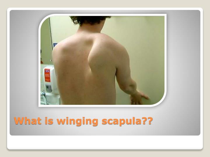 PPT - Winging of scapula PowerPoint Presentation - ID:2449329