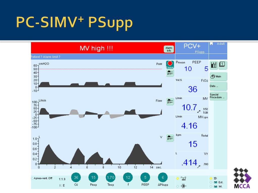 PPT - Synchronized Intermittent Mandatory Ventilation: SIMV ...