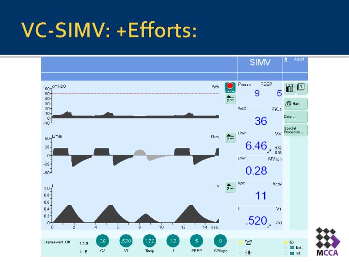 PPT - Synchronized Intermittent Mandatory Ventilation: SIMV PowerPoint ...