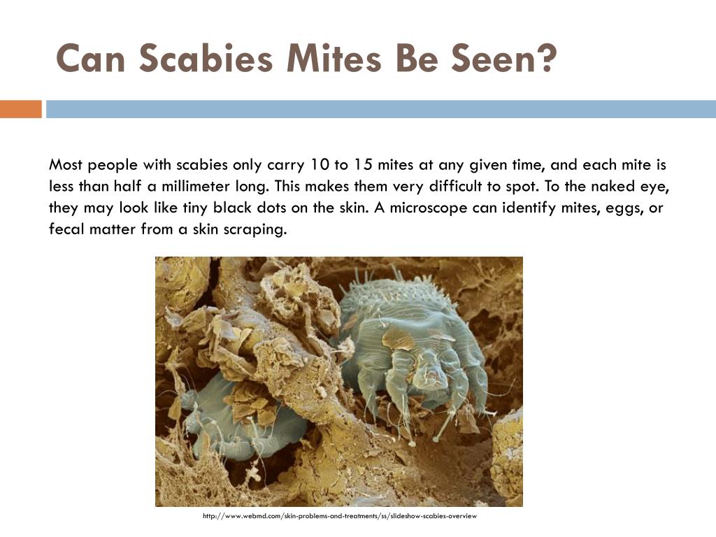 Ppt What Is Scabies Powerpoint Presentation Free Download Id2457230