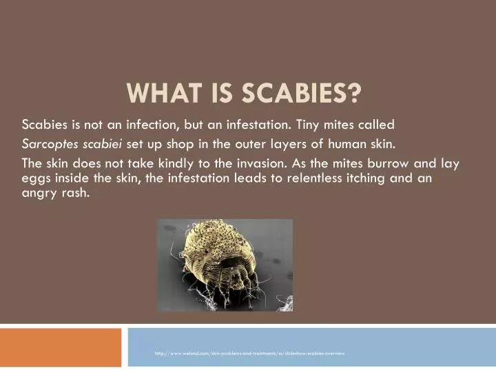 PPT - What Is Scabies? PowerPoint Presentation - ID:2457230