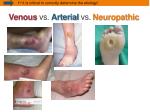 PPT - Venous Stasis Management and Ulcer Healing PowerPoint ...