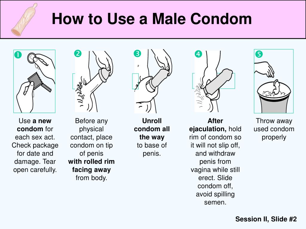 PPT - Male Condoms PowerPoint Presentation, free download - ID:2469107