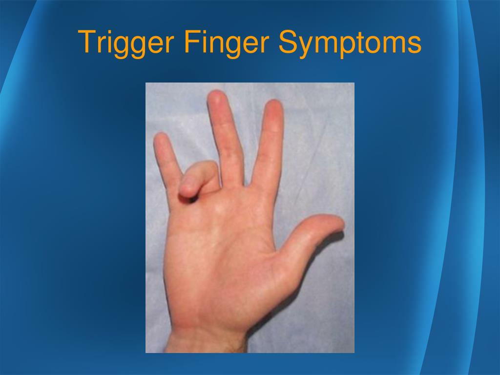 Ppt Trigger Finger Powerpoint Presentation Free Download Id2482335