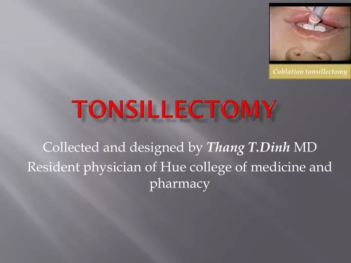 tonsillectomy n.