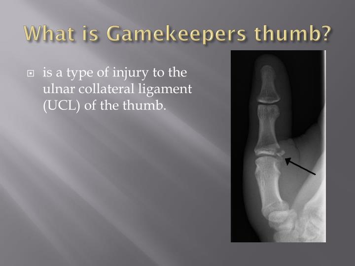PPT Gamekeepers thumb PowerPoint Presentation ID2491696