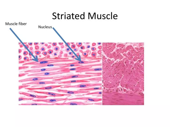 cardiac muscle striations