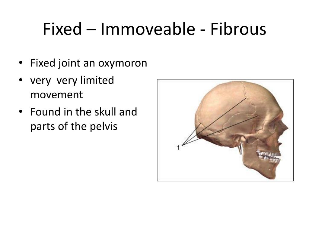 fixed joint skull